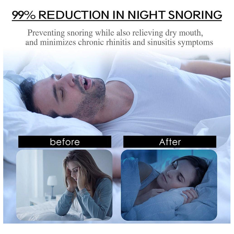 Cinta Dormir Boca Anti Ronquido Hipoalergenica X30 Negro Unica